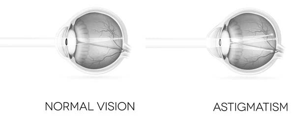 Est Eye 5 eye conditions you don’t know about – The Eye Establishment